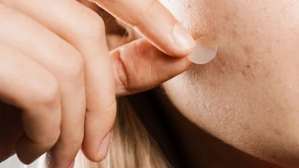 Woman removing a pimple patch