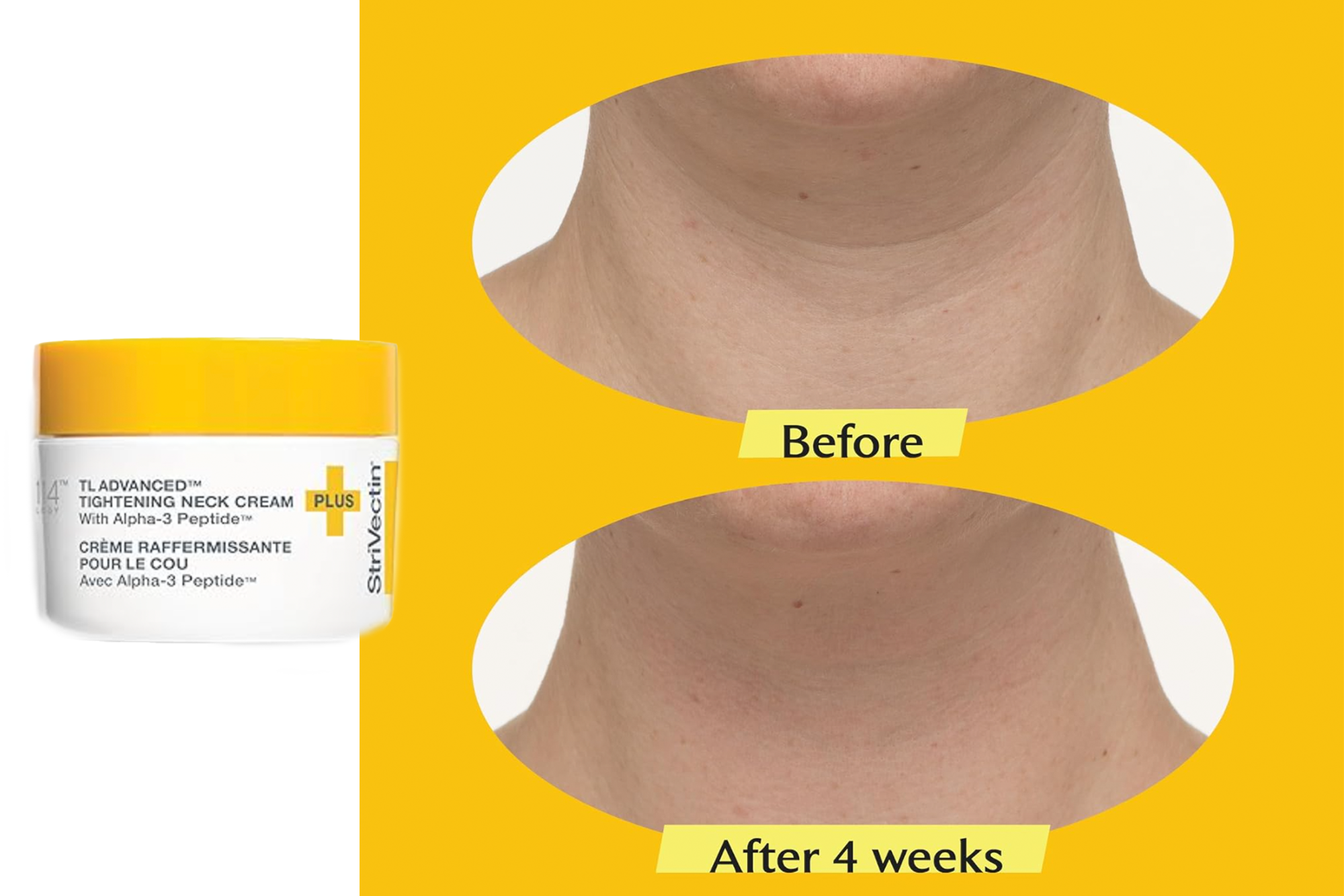 StriVectin neck cream