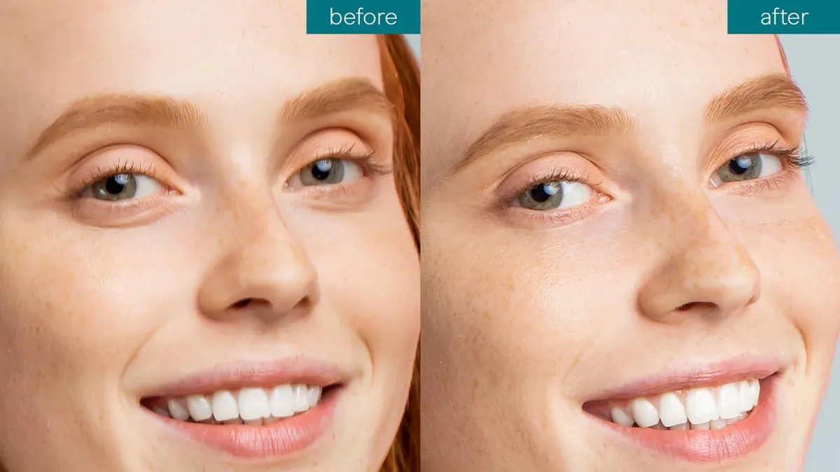 amazon-baebody-eye-gel-before-after