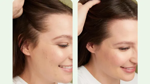 amazon-divi-scalp-serum-before-after