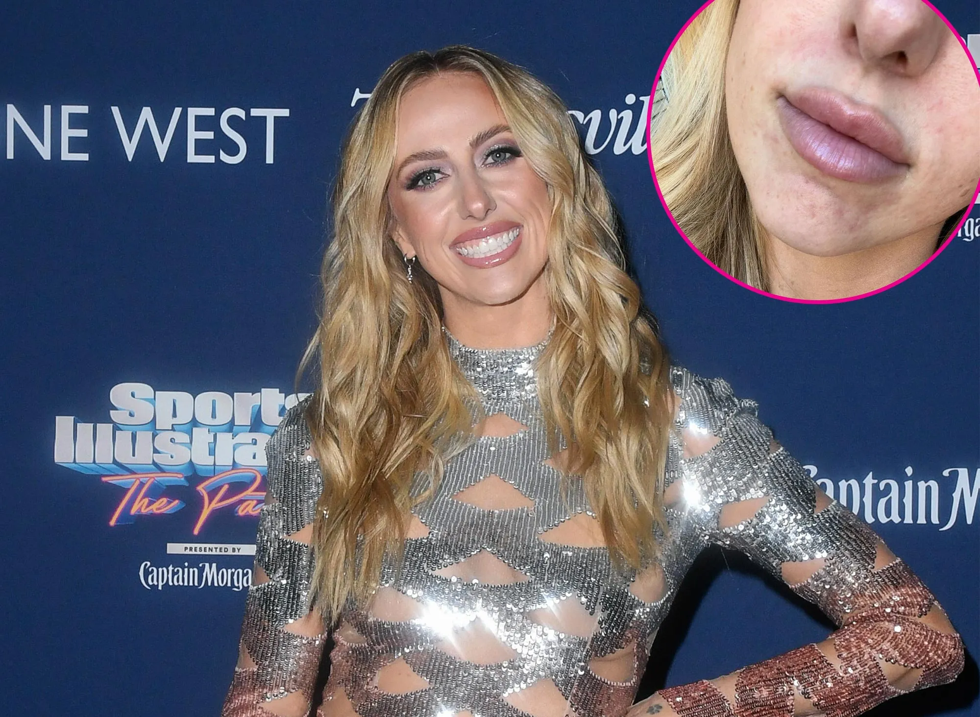 Brittany Mahomes Admits She s Really Struggling With Acne Breakouts 497