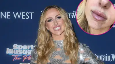 Brittany Mahomes Admits She s Really Struggling With Acne Breakouts 497