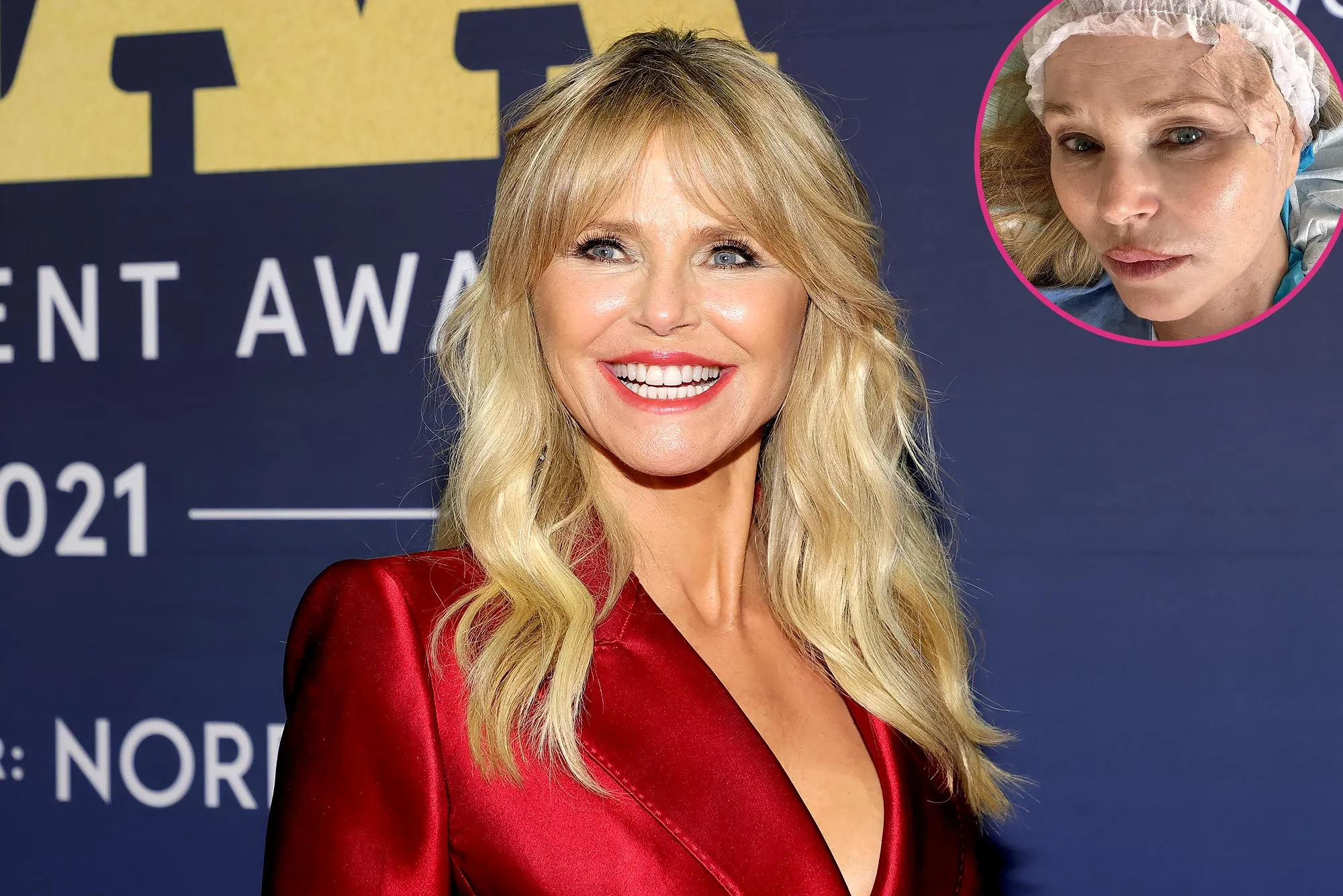 Christie Brinkley Reveals Skin Cancer Diagnosis: 'We Caught the Basal Cell Carcinoma Early'