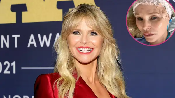 Christie Brinkley Reveals Skin Cancer Diagnosis: 'We Caught the Basal Cell Carcinoma Early'