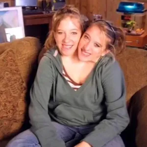 Conjoined twins Abby Hensel and Brittany Hensel Josh Bowling