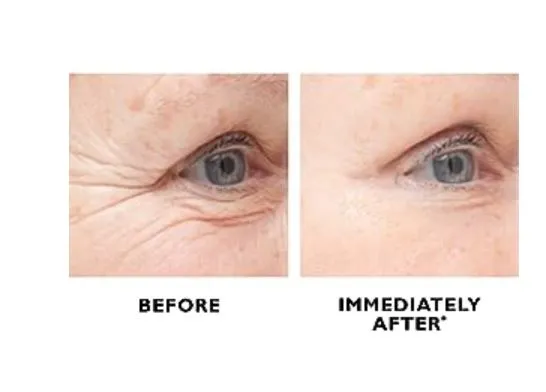 Peter Thomas Roth Instant FirmX Temporary Eye Treatment