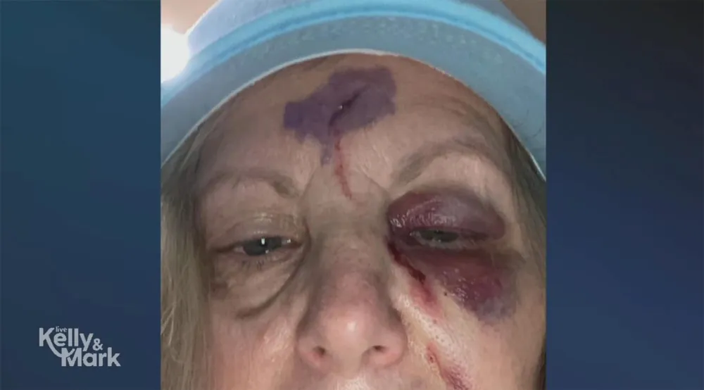 Howie Mandel Says He Found Wife Terry in Pool of Blood During Recent Vegas Trip Gone Wrong