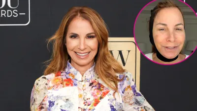 Jill Zaren Face Lift