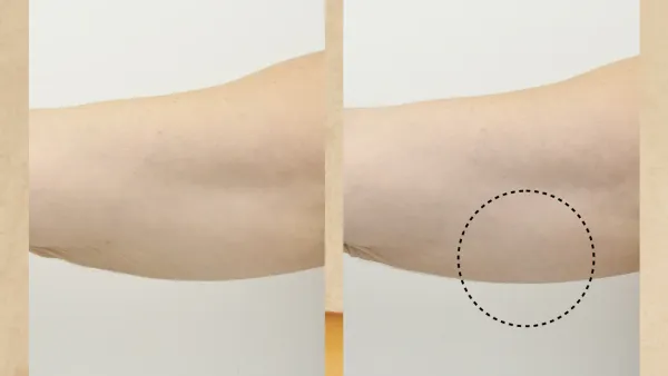 QUINOA FIRMING BODY LOTION Arm