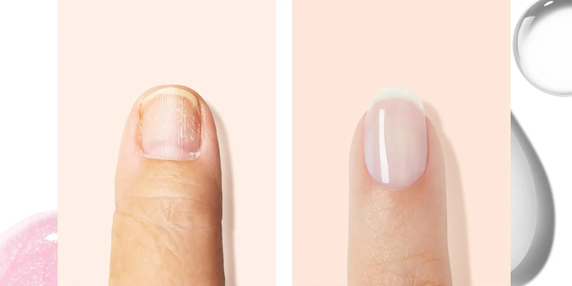 amazon-modelones-nail-ridge-filler