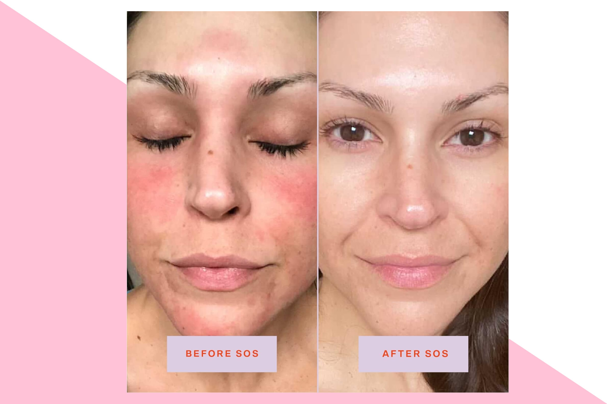 Tower 28 SOS Daily Rescue Facial Spray for Sensitive Skin