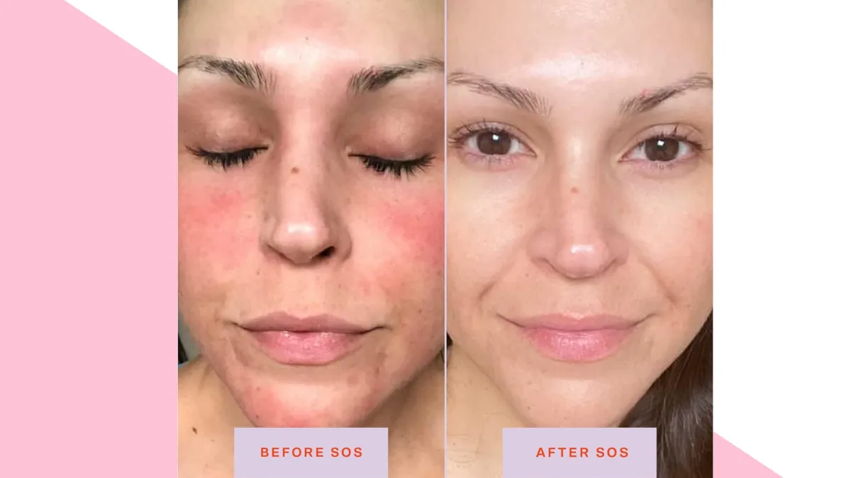 Tower 28 SOS Daily Rescue Facial Spray for Sensitive Skin