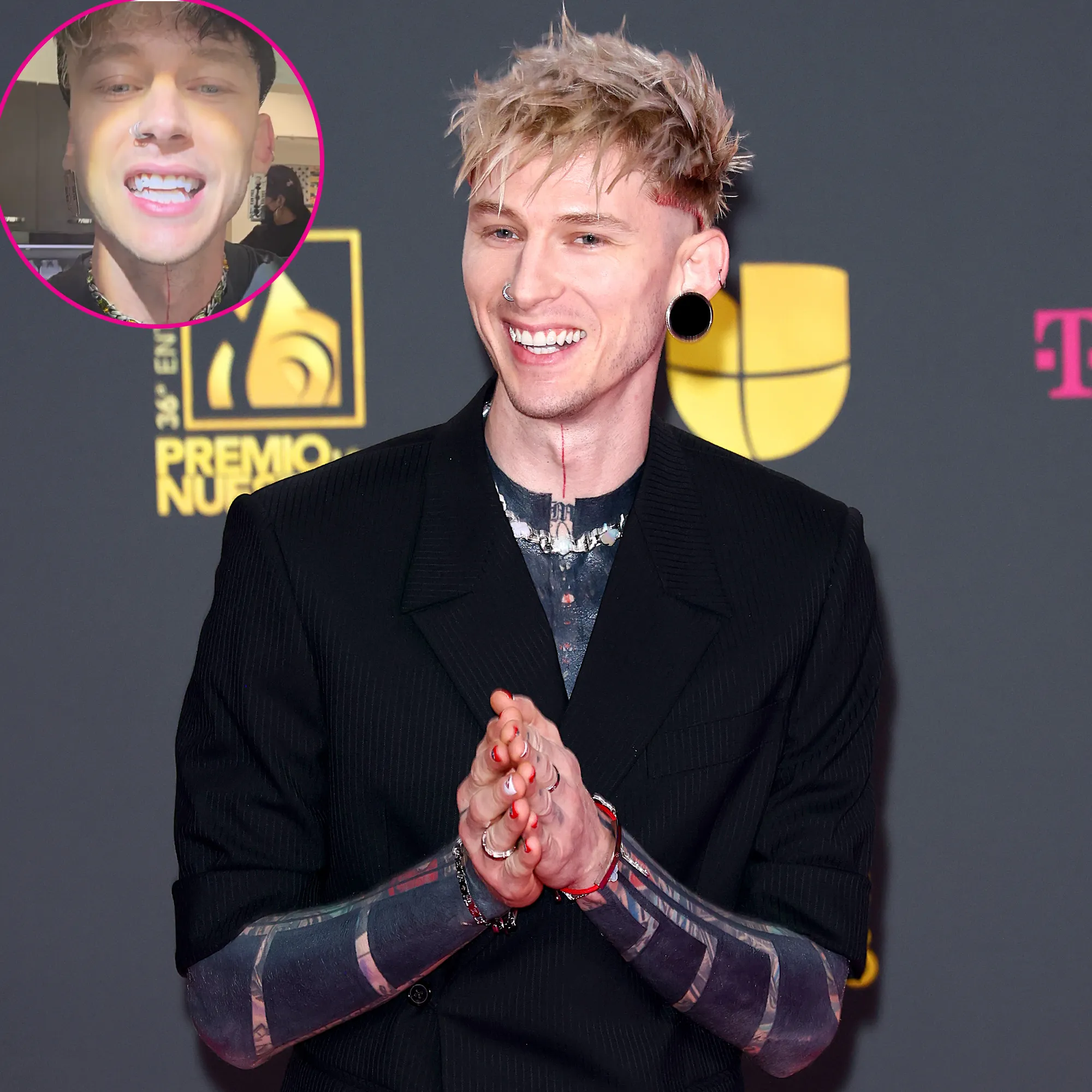 Machine Gun Kelly Shows Off New Fangs