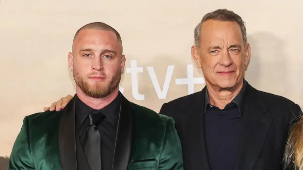 Tom Hanks Son Chet Hanks Has No Shame After Getting His Forehead Blasted With Botox 493