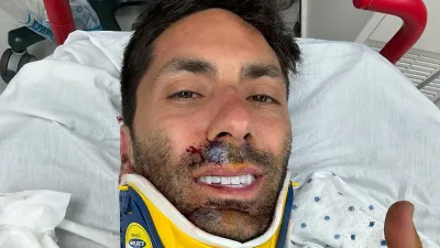 Nev Schulman Breaks Neck: 'I'm Not Paralyzed'