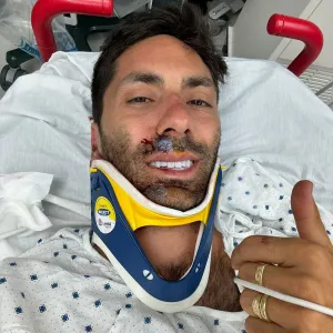 Nev Schulman Breaks Neck: 'I'm Not Paralyzed'
