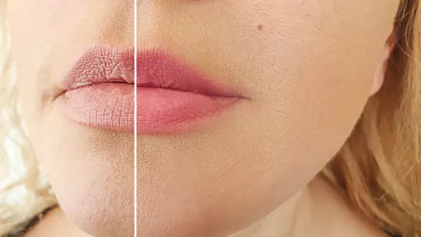 woman face wrinkles before and after correction