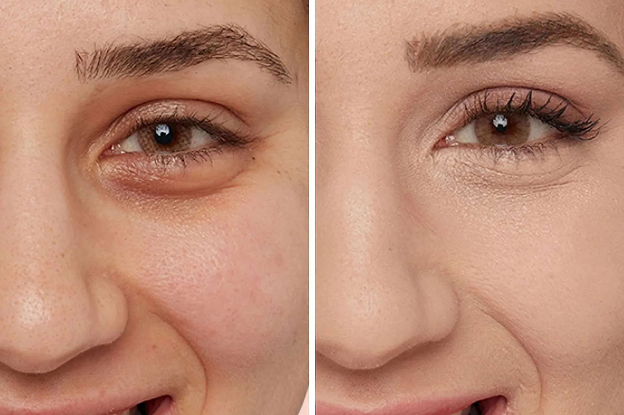 before and after concealer picture of woman for IT Cosmetics