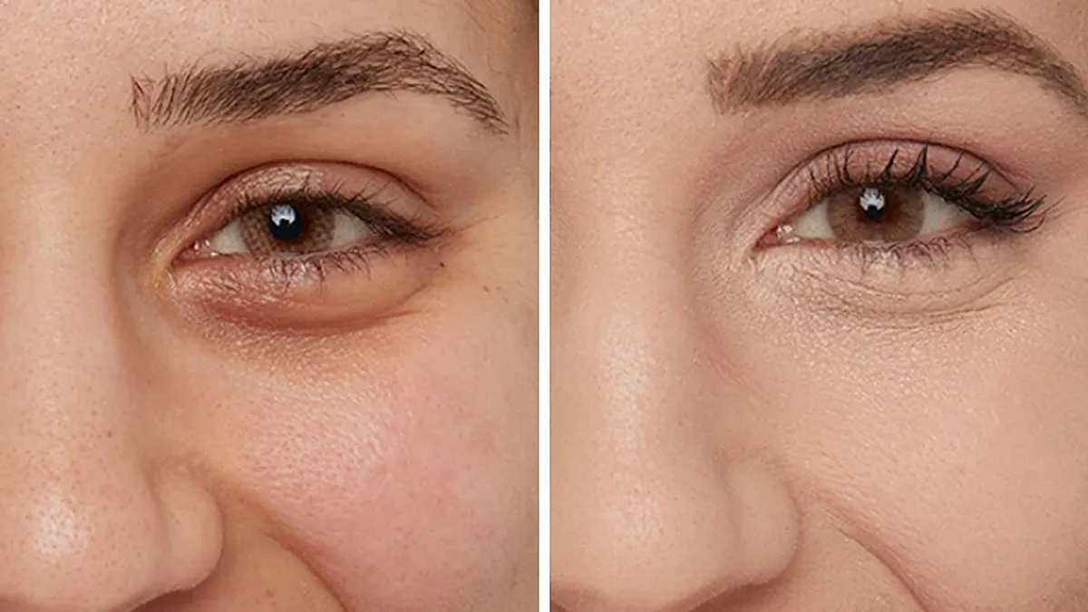 before and after concealer picture of woman for IT Cosmetics