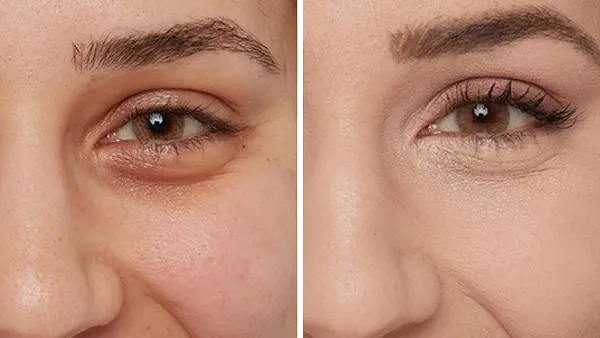 before and after concealer picture of woman for IT Cosmetics