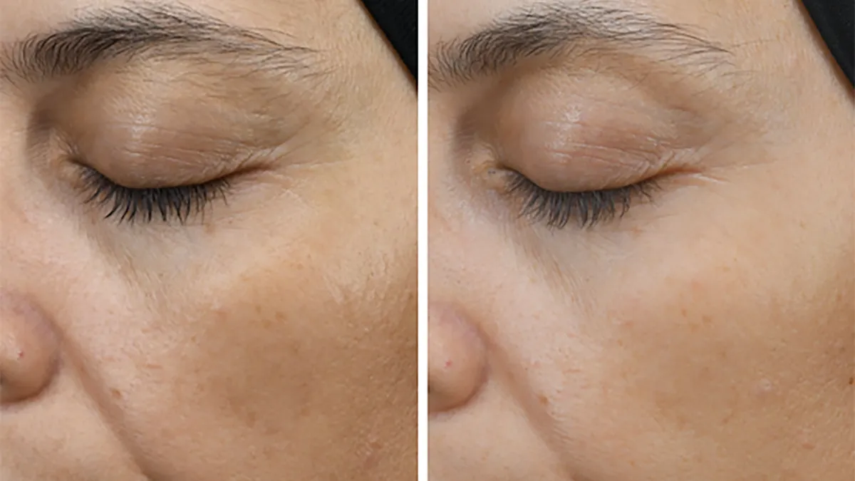 shaklee-sculpting-wand