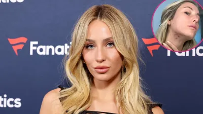 Alix Earle Shares Her Go to Method of Concealing Acne