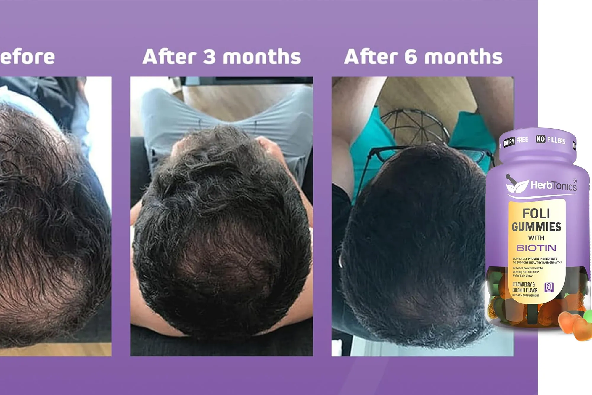 Herbtonics Foli Gummies