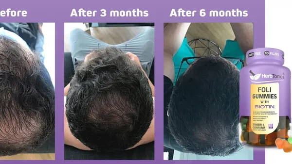 Herbtonics Foli Gummies