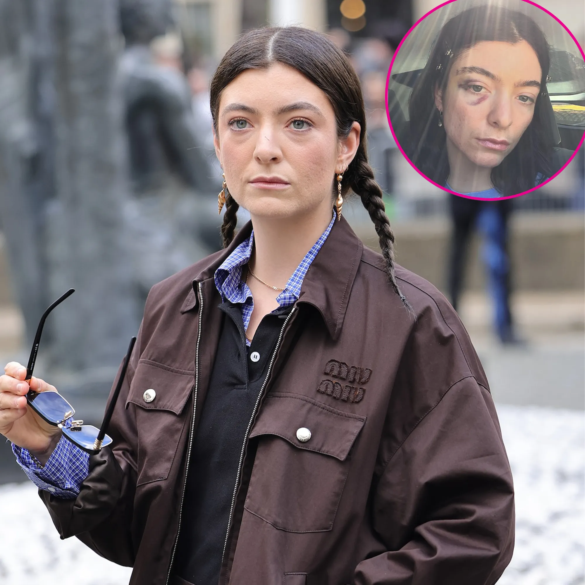 Lorde Deletes Everything From Her Instagram Except New Black Eye Photos