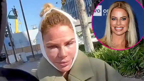 Real Housewives Craziest Post Surgery Pics