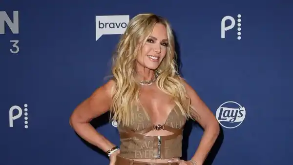 Tamra Judge Shares Mom’s Reaction to Her Face Amid Brow Lift Recovery