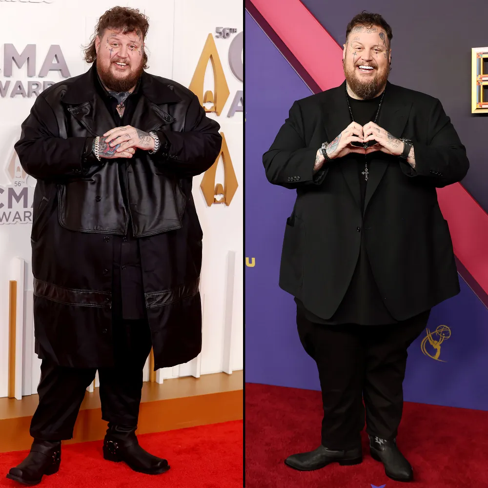 Jelly Roll Reveals He Lost 100 Lbs Before and After