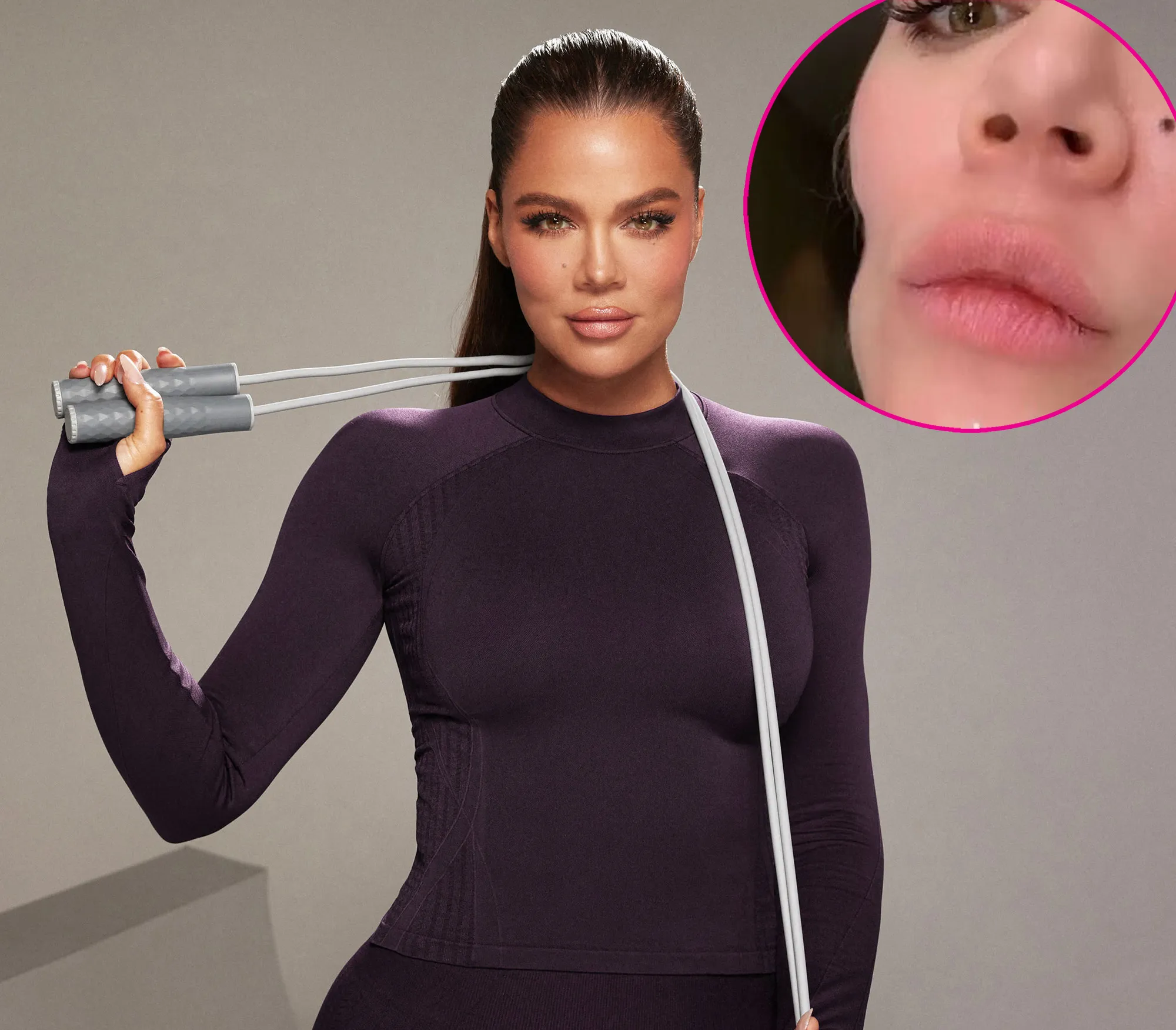 Khloe Kardashian Before andv After Facial Injections