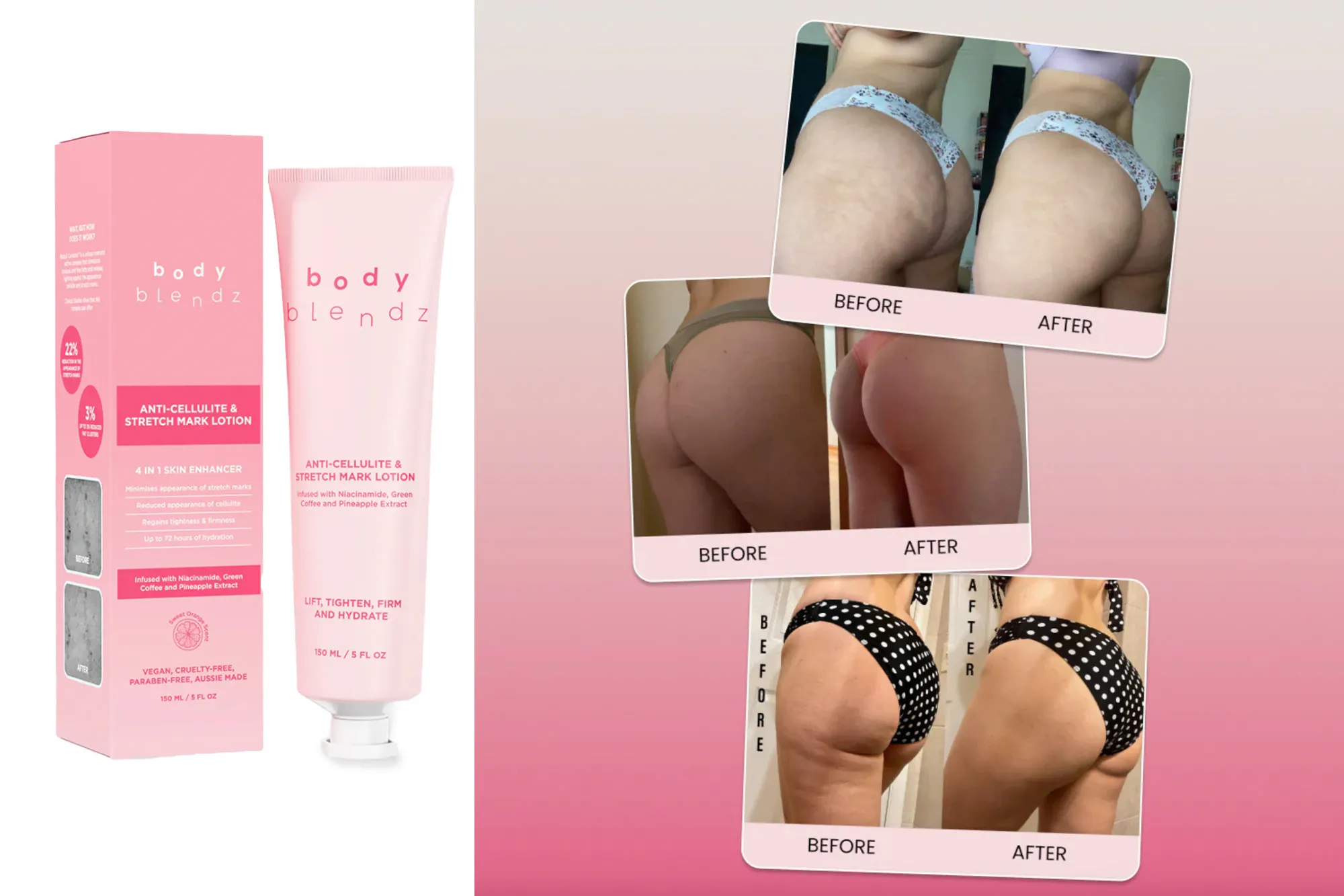 BodyBlendz anti-cellulite and stretch marks body lotion