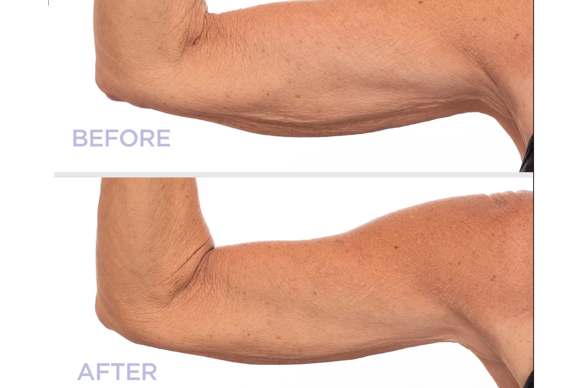 GoPure Sculpt and Tone Arm Cream