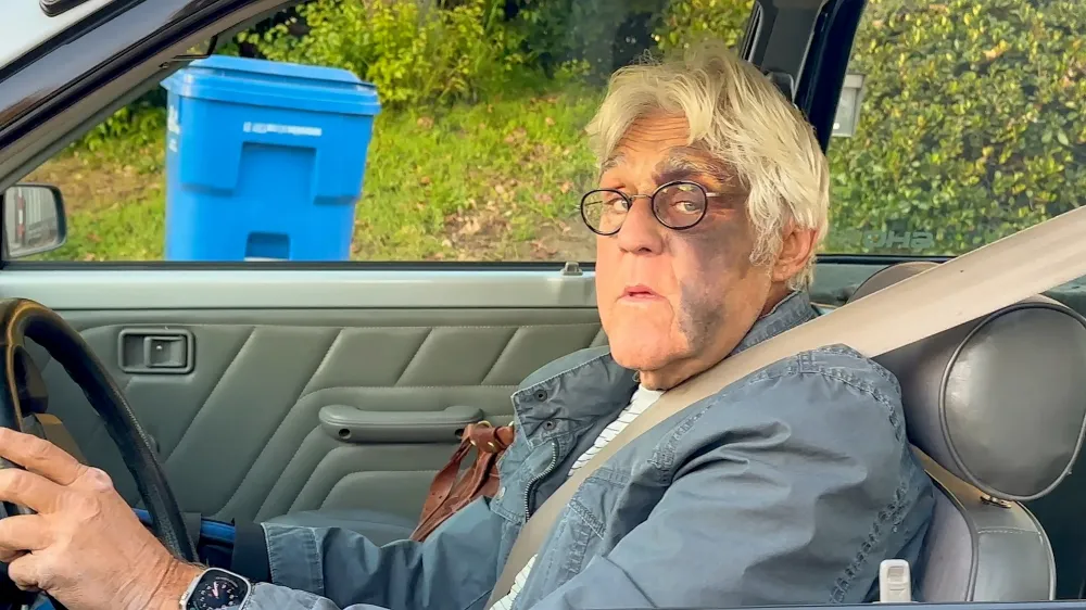 Jay Leno Spotted With Giant Bruise