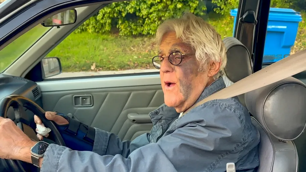 Jay Leno Spotted With Giant Bruise