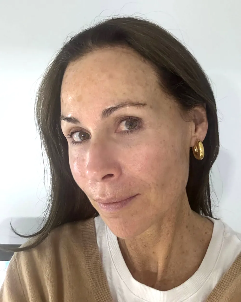 Minnie Driver Posts Barefaced Selfie After Facing Illness