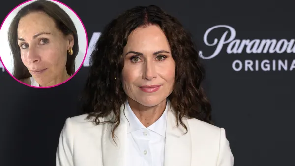 Minnie Driver Posts Barefaced Selfie After Facing Illness