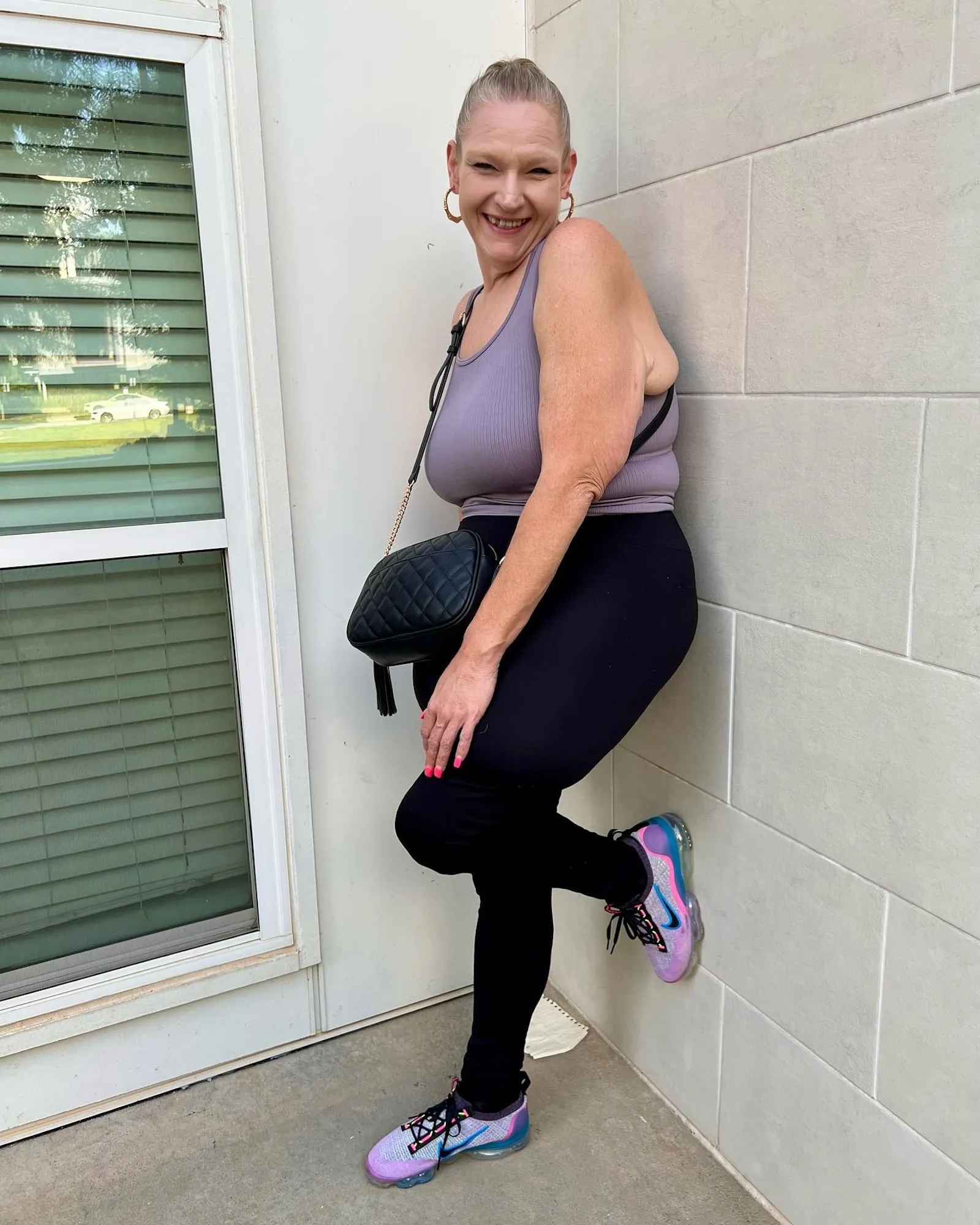 TLC s 1000 LB Best Friends Vannessa s skin removal surgery