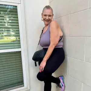 TLC s 1000 LB Best Friends Vannessa s skin removal surgery