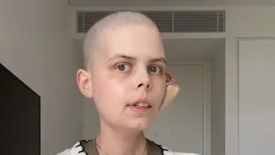 TikTok Star Bella Bradford Announces Her Own Death at Age 24 With TikTok Video After Cancer Battle