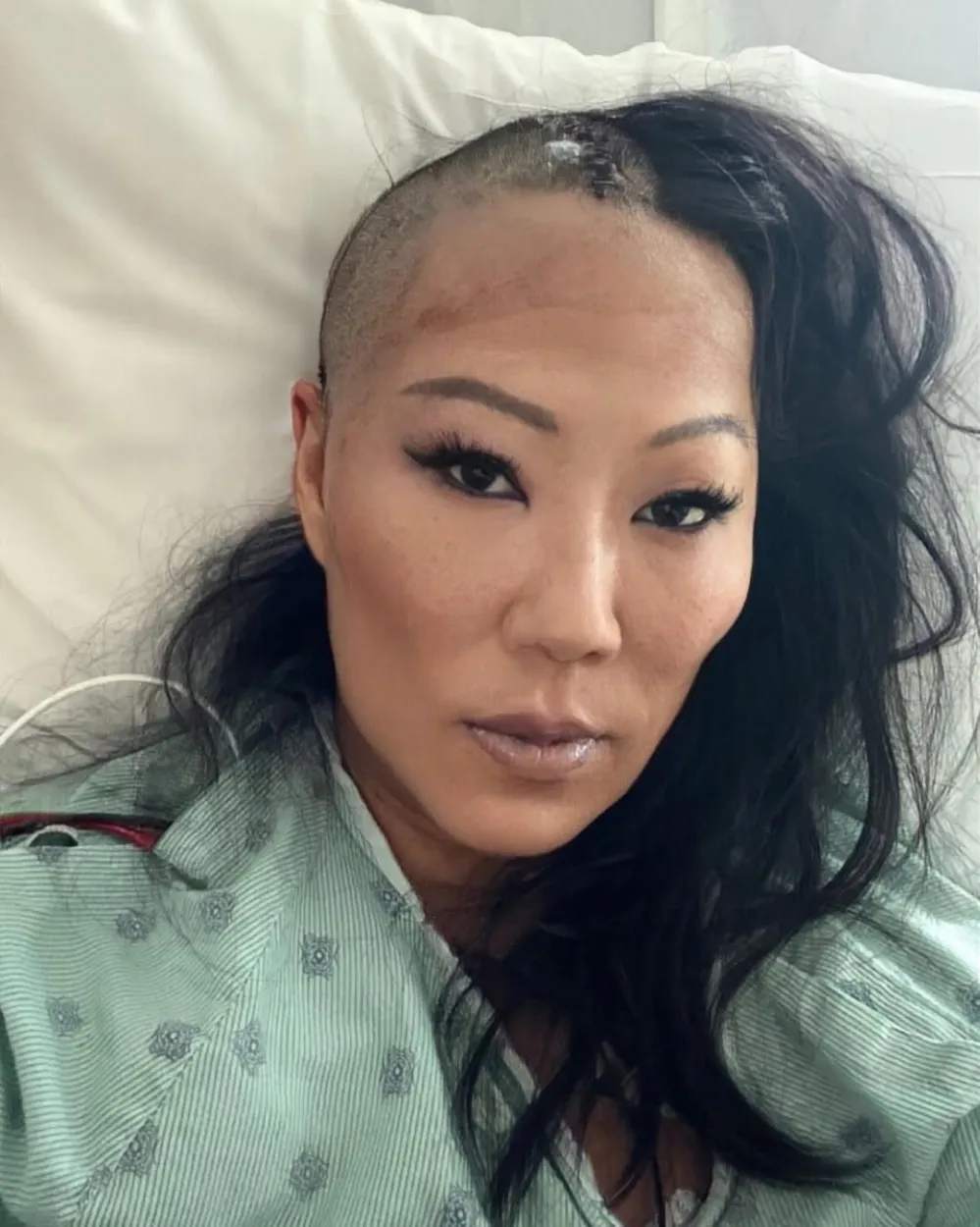 Bling Empire New York Star Lynn Ban Has Emergency Brain Surgery Following Ski Accident
