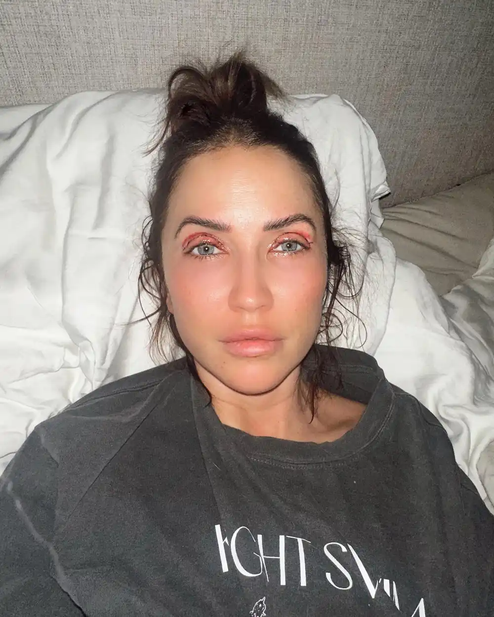 Bachelorettes Kaitlyn Bristowe Shares Post Eyelid Surgery Selfie