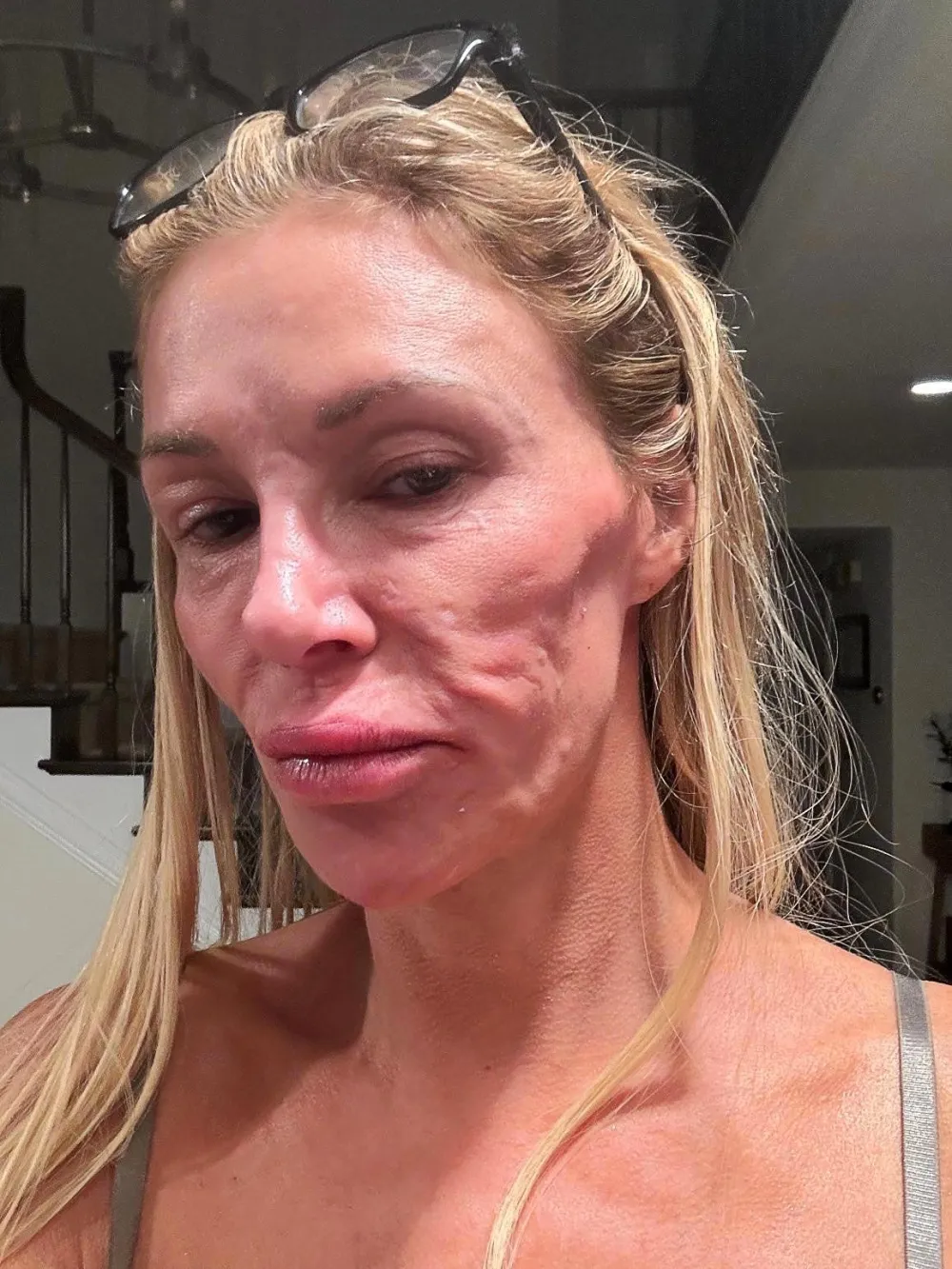 Brandi Glanville Thinks She Looks Like a Crackhead With Parasite 495