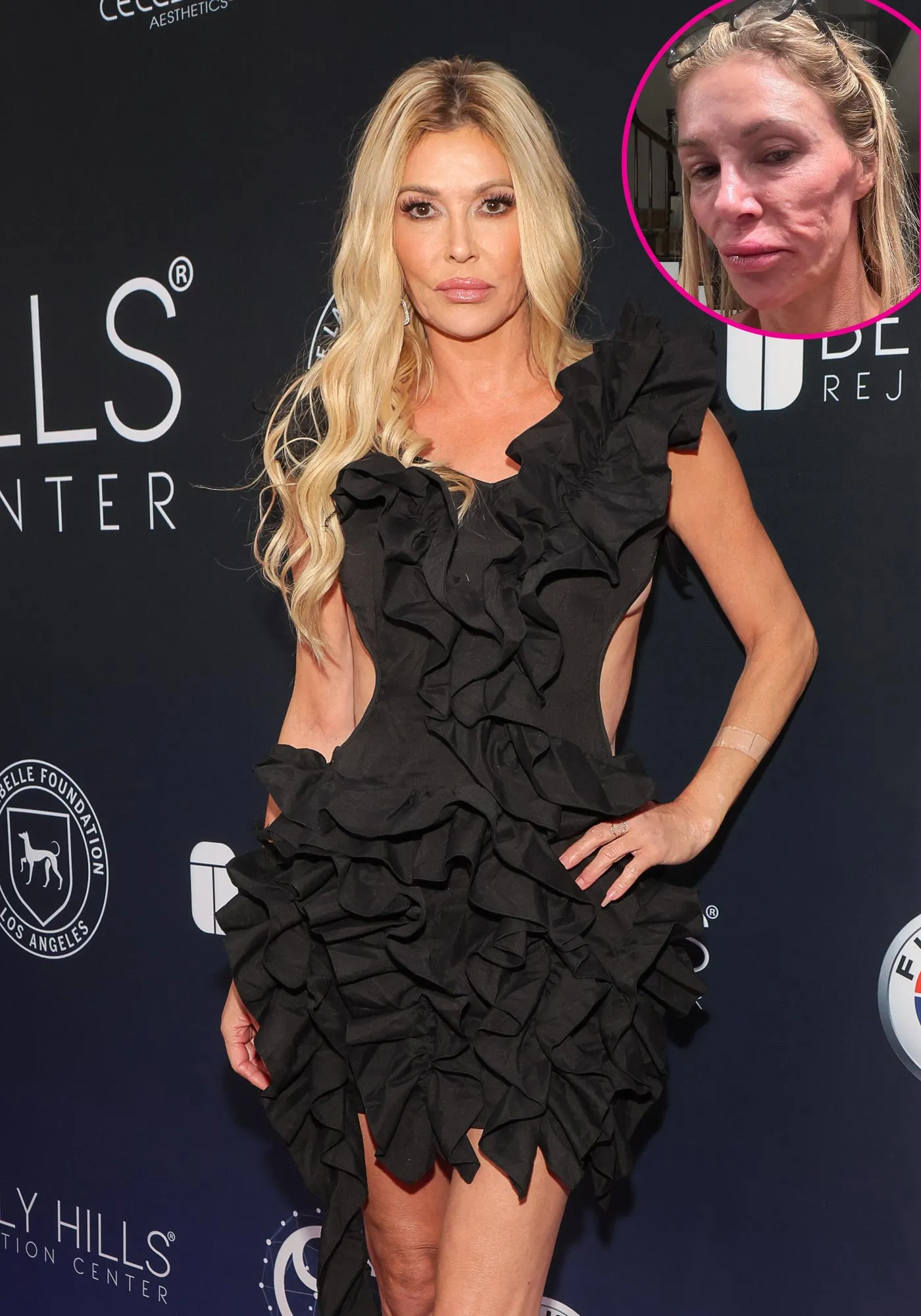 Brandi Glanville Thinks She Looks Like a Crackhead With Parasite 497
