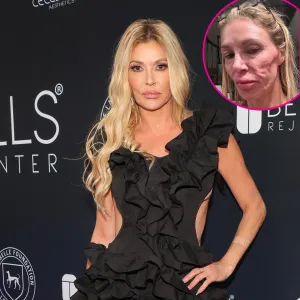 Brandi Glanville Thinks She Looks Like a Crackhead With Parasite 497