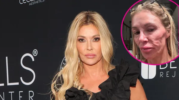 Brandi Glanville Thinks She Looks Like a Crackhead With Parasite 497