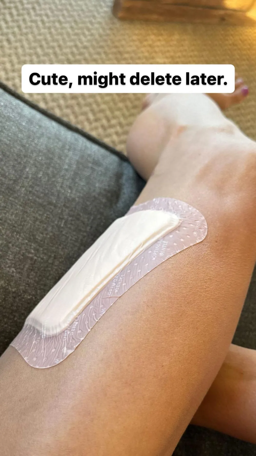 Danica Patrick Shares Gnarly Photos After Getting Burned by Starbucks Hot Water