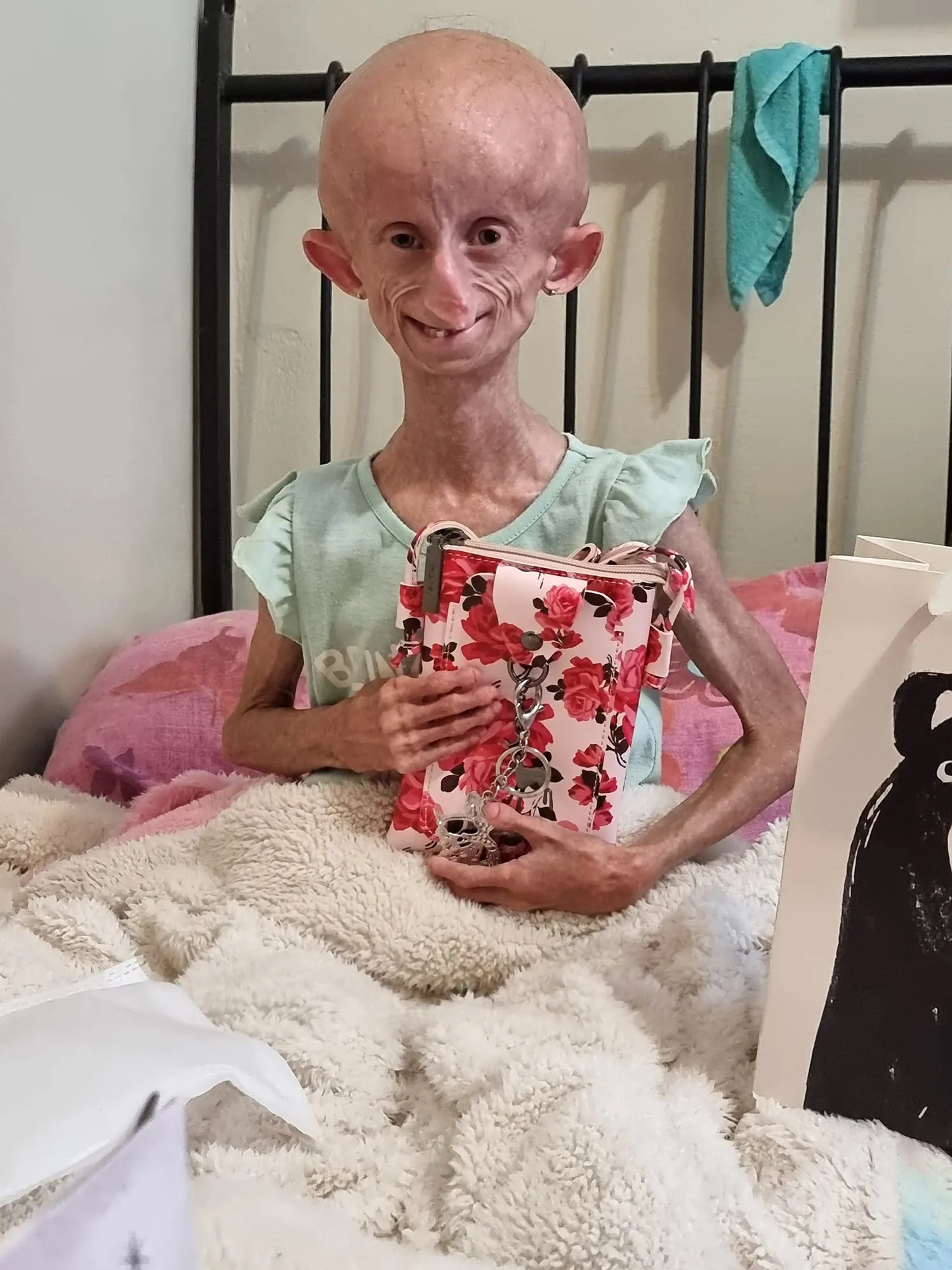 TikTok Star Beandri Booysen Dies at 19 From Rare Aging Disease